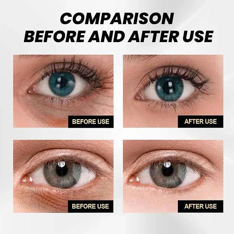 CËLYN Eye Cream Instant Firm Lifting Eye Bag Wrinkles Removal Dark Circle Remover Eyes Skin Beauty Care Original 30ml_voghion.com