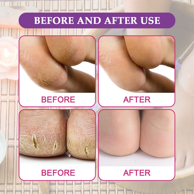 Fußbadesalz pflegt die Haut der Füße, reinigt tiefenwirksam, lindert Muskelkater, macht den Körper schlank und vertreibt Erkältungen. Fußbadesalz_voghion.com