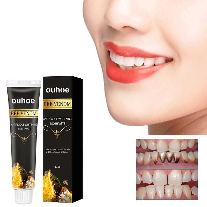 Pasta de dientes OUHOE Blanqueamiento de manchas de dientes, manchas de dientes amarillas, eliminación de olores bucales, chicle de coche_voghion.com