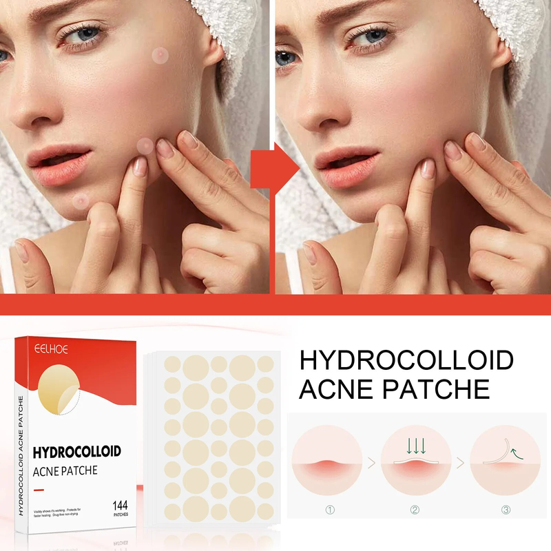 Hydrocolloid Acne Invisible Makeup Closed Mouth Acne Patch Clean Acne Waterproof Breathable Acne Muscle Repair Patch Female Male_voghion.com
