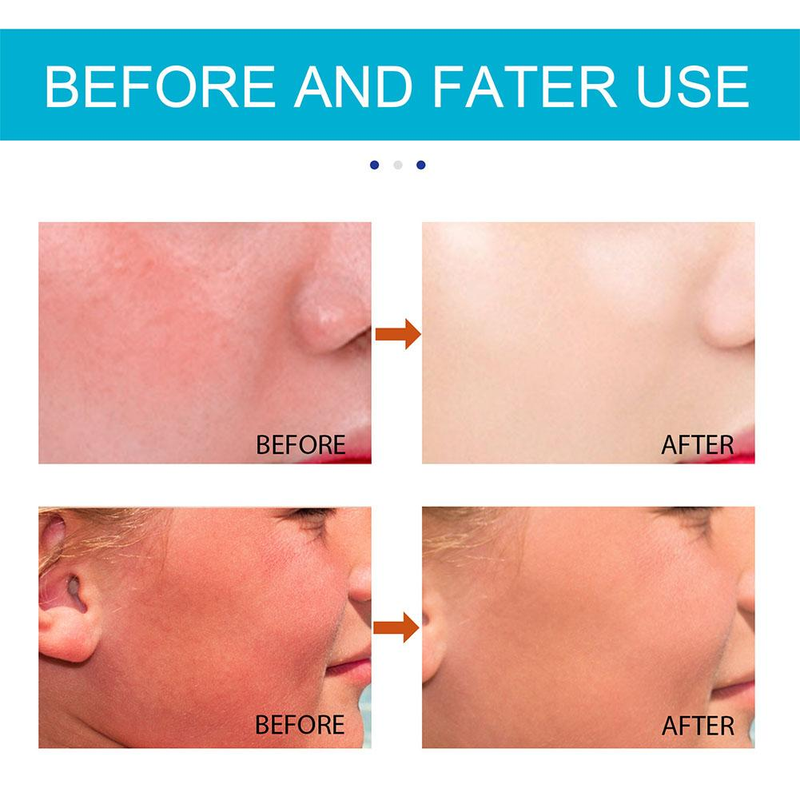 QLZHANFU Zonnebrandcrème Isolatie Crème Sunblock Stick Body Whitening Hydraterende Verhelderende Zonnebrandcrème UV Protector Concealer_voghion.com