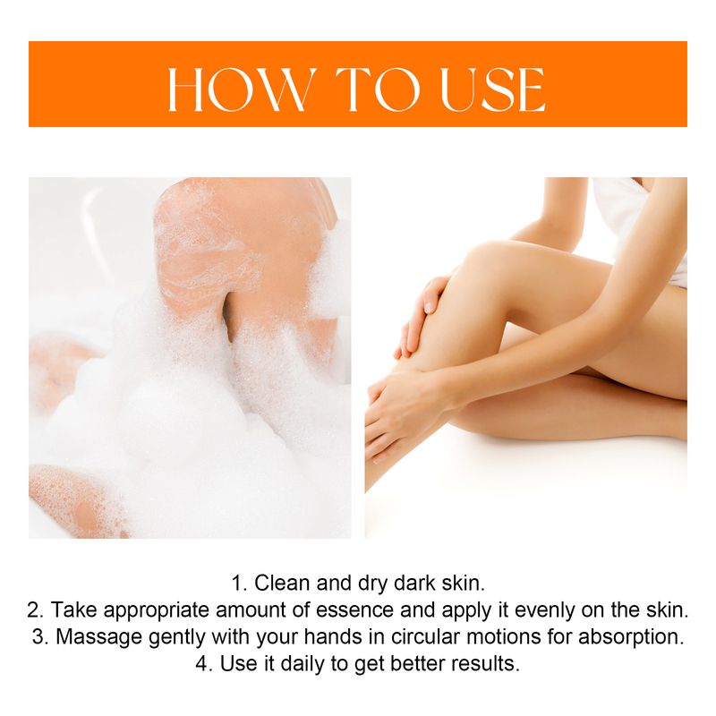 2024 new Acne Whitening Elbow, Axillary, Knee Joint, Black Skin Brightening essence_voghion.com