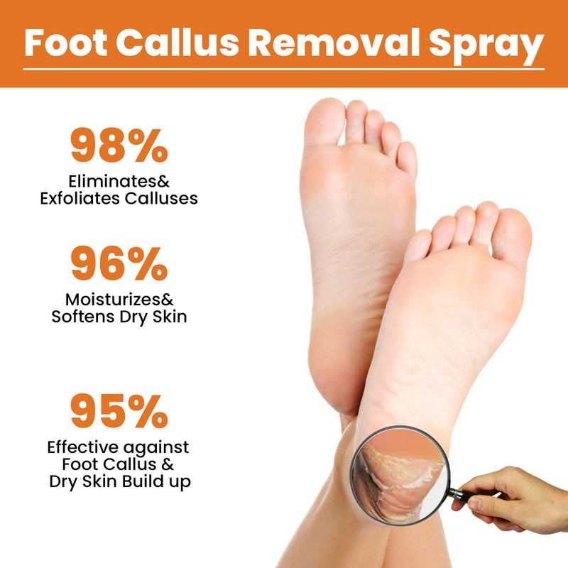 Spray exfoliant pour les pieds pour les peaux mortes, hydratant, nettoyant, réparateur, peau rugueuse et éliminant les callosités 2024 le plus populaire_voghion.com