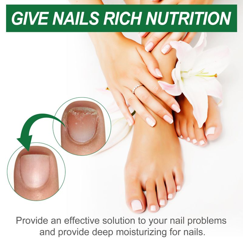 Ximonth Toenail Hand And Foot Cleaning Maintenance Moisturizing Shine Nail Care Daily Solution_voghion.com