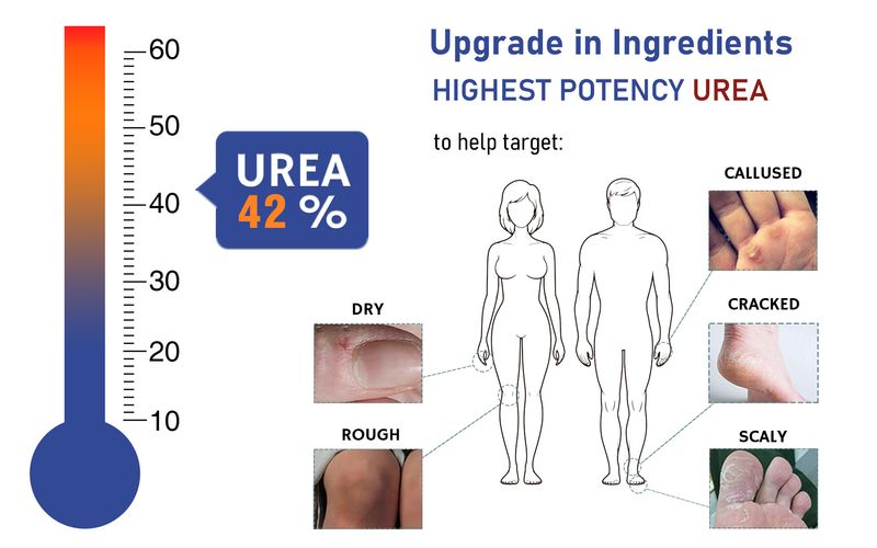 Fußpflege 42% Harnstoffcreme + 2% Salicylsäure Anti-Trocknung und Feuchtigkeitsspendende Starke Feuchtigkeitsreparatur Grobes Englisch_voghion.com