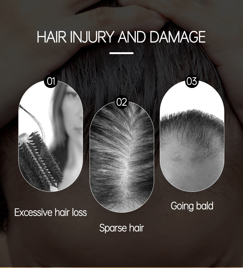 Hairinque fluffy long conserved essential oil growth hair care scalp nutrition ball essay_voghion.com