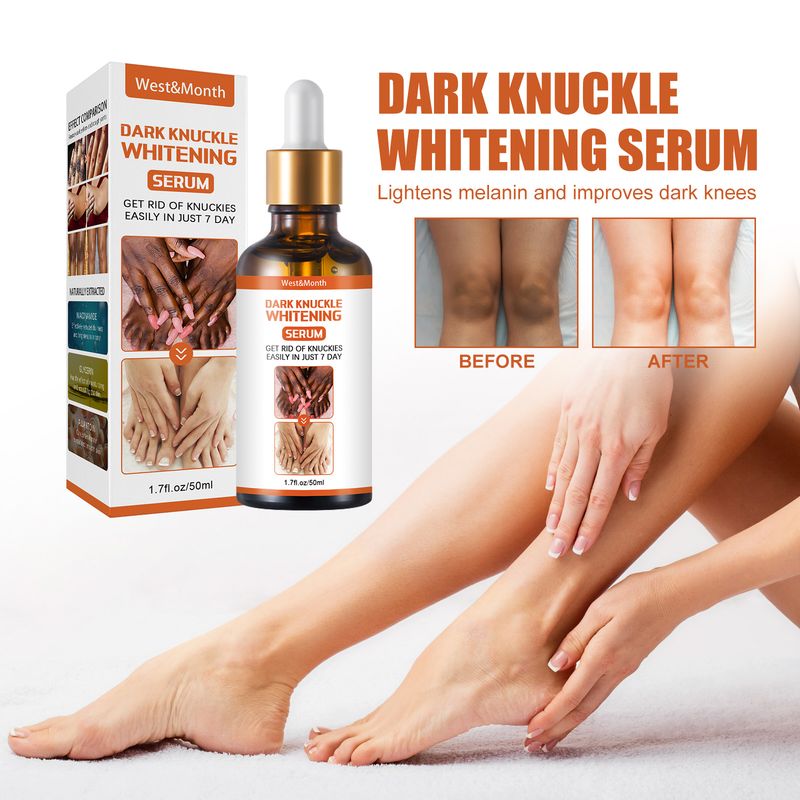 West&Month Skin Blackening Essence, vlažilna esenca za posvetlitev kolen in gležnjev, odstranjevanje melanina iz rogov_voghion.com