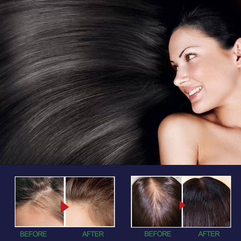 Dichtes Spray, starkes, festes, befeuchtendes, dichtes, haariges, beschädigtes, trockenes und pflegendes ätherisches Öl_voghion.com