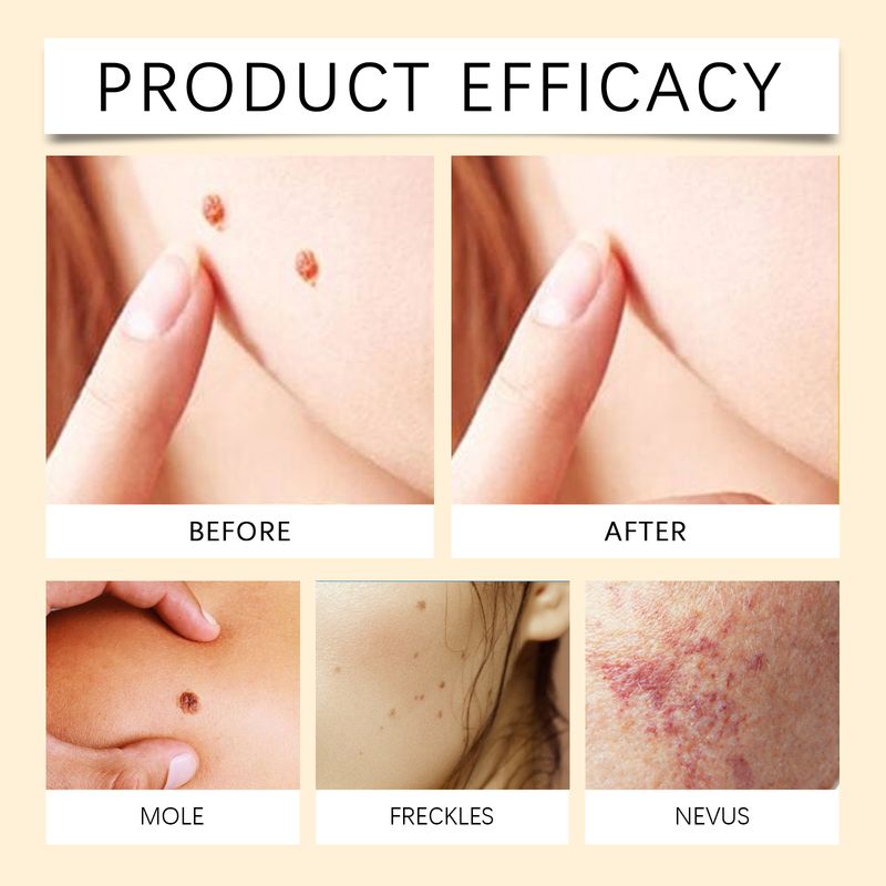 Houkea Bee Venom Skin Serum, A Moisturizing, Gentle And Restorative Cleansing And Smooth Skin Care Solution_voghion.com