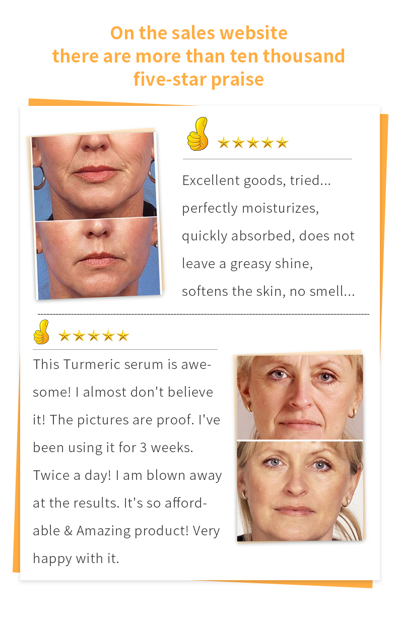 Lemon Oil Turmeric Glow To Lightening Patches, Acne Bright Skin Dark Spot Corrector Face Whitening S_voghion.com
