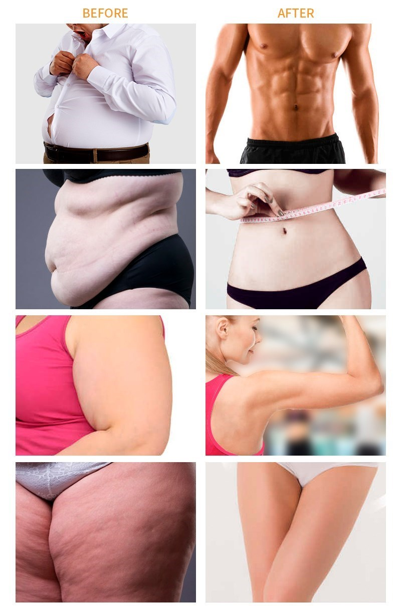 Slimming Cream Weight Loss Remove Cellulite Sweat Massage Fast Belly Fat Burning Lifting Tighten Shaping Waist Body Care Product_voghion.com