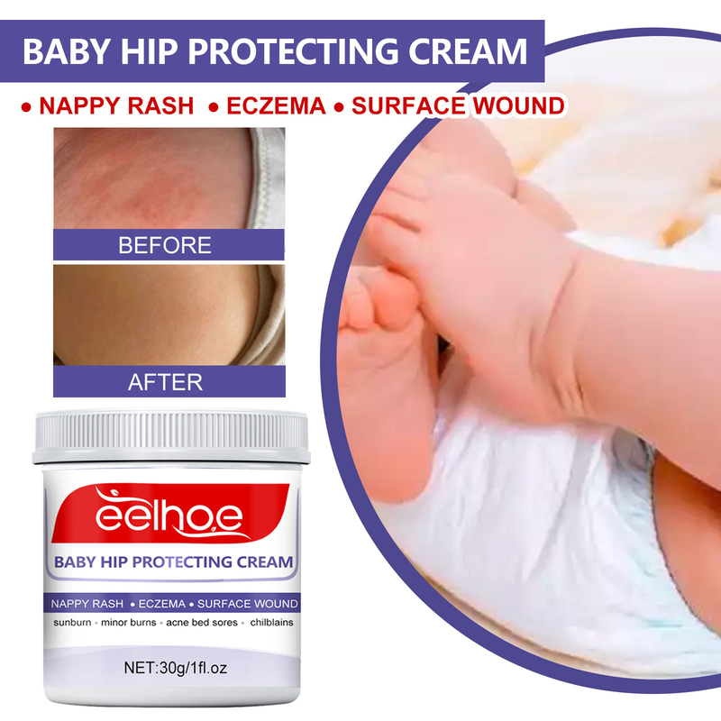 Hip Beautiful Baby Cream repariert Rötungen, Fieber und Juckreiz an der Babyhüfte und ist eine feuchtigkeitsspendende Hautpflegecreme_voghion.com