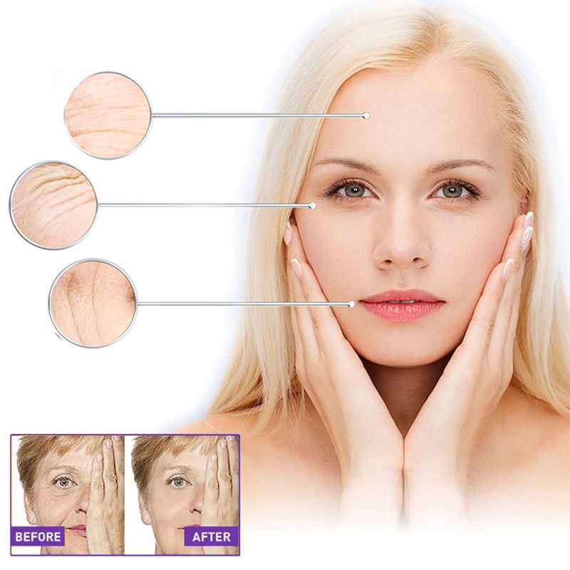 EELHOE Facial Wrinkle Patch, Droop Decree Line Lift Facial Skin Tightens Mouth Line Cheek Patch_voghion.com