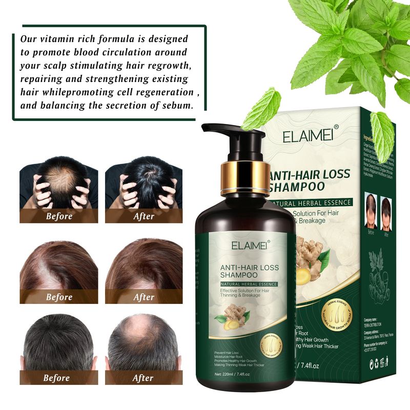 ELAIMEI Ginger Shampoo conditioner for scalp removal, hair firming, deep cleansing and care set_voghion.com