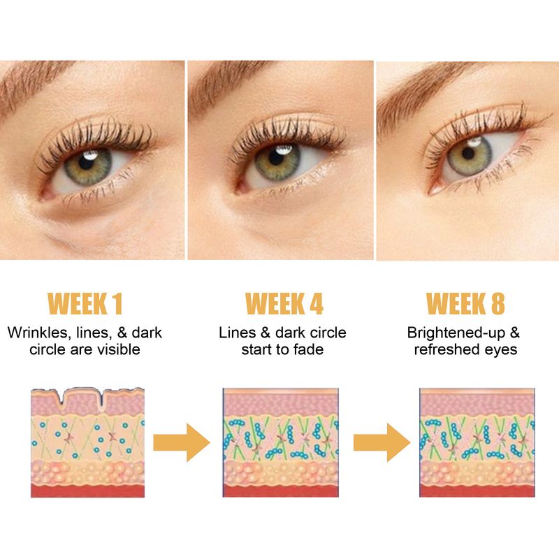 EELOHE Retinol Peptide Repair Eye Cream Firms Eyes, Reduces Dark Circles, Fine Lines, And Tightens The Skin_voghion.com