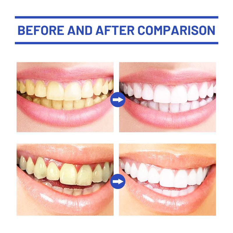 Oralhoe Cleansing for Fresh Breath, Brightening Whitening Teeth, Cleaning Stains Stains, and Oral Care Tooth Powder_voghion.com