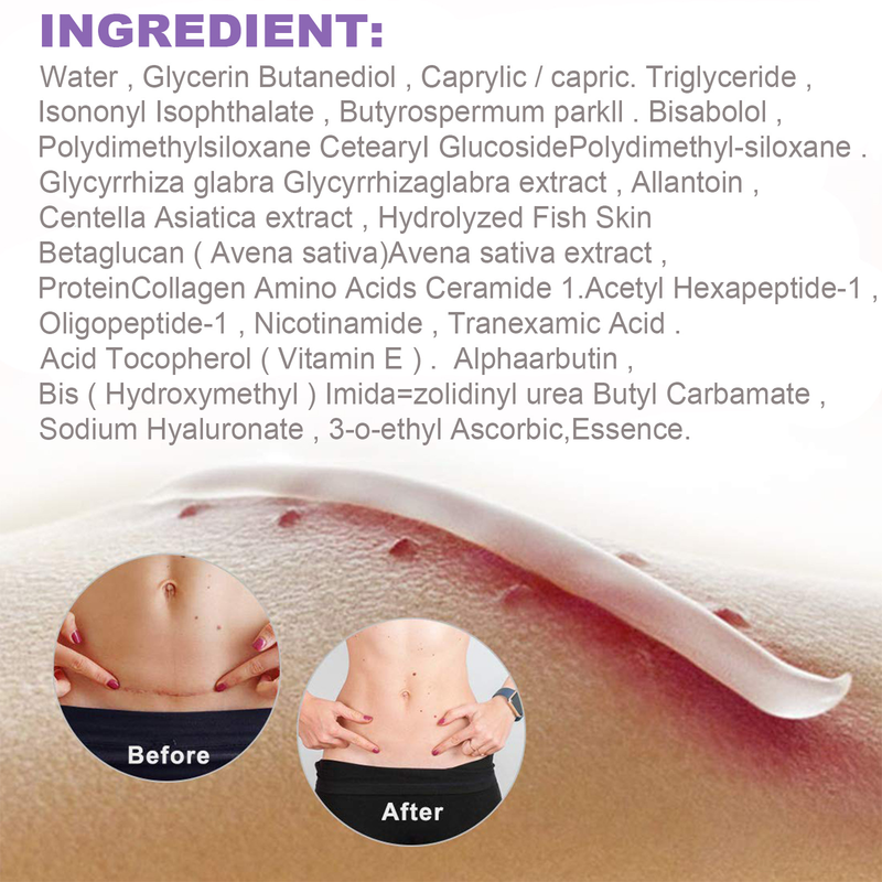 EELHOE Narbe zur Aufhellung postoperativer Narben, zur Glättung der Haut, zur Reparatur und Befeuchtung der Hautpflegecreme_voghion.com
