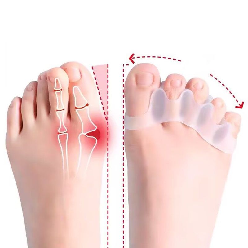 Separatore dita in silicone da 2 pezzi, dita dei piedi, divaricatore dita, alluce valgo, correttore di dita dei piedi, separatore di dita_voghion.com