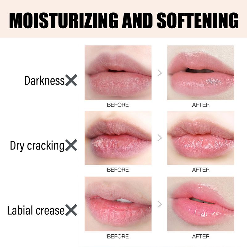 EelHope Lip Lightening Balm, It Moisturizes Fade Lip Lines To Prevent Weather-Shack Dead Skin Moisturizing Lip Care_voghion.com