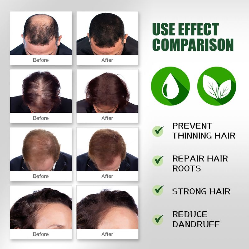 Essenza per capelli densa e rinforzante allo zenzero per la crescita dei capelli_voghion.com