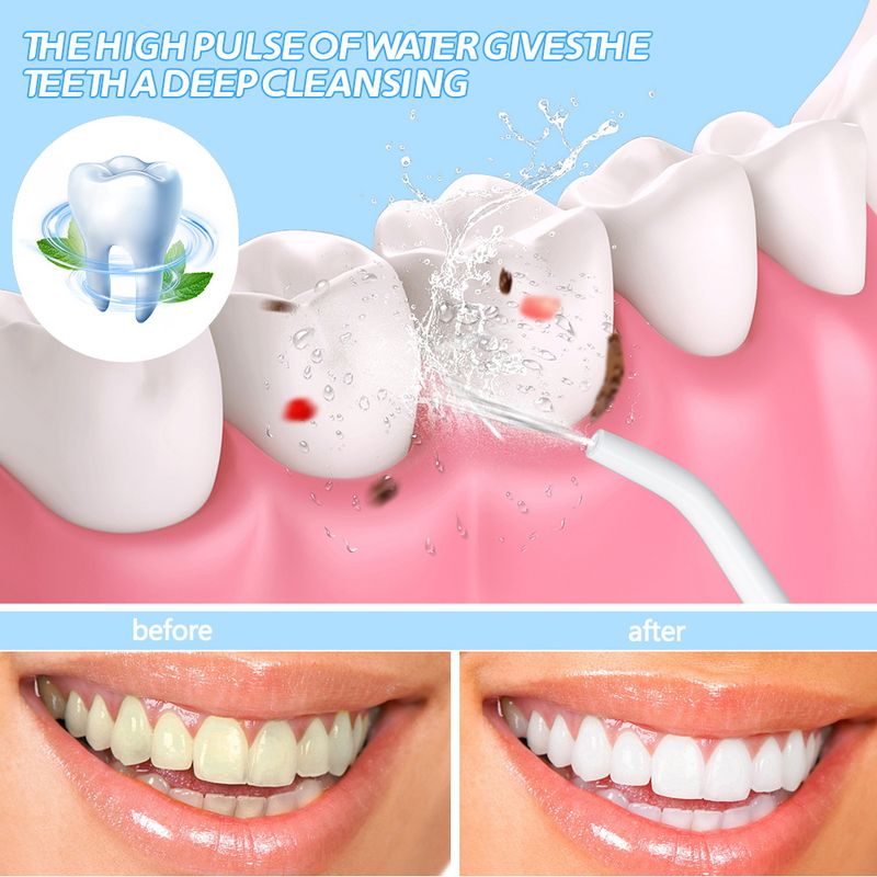 Ață dentară electrică, ață dentară portabilă cu apă, îndepărtarea tartrului, încărcare, curățare orală portabilă și curățarea dinților_voghion.com