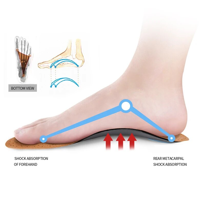 Ortopediske innleggssåler i skinn, flate innleggssåler for fotbue, ortopediske sko, for menn og kvinner, O/X-benkorrigert pleiepute_voghion.com