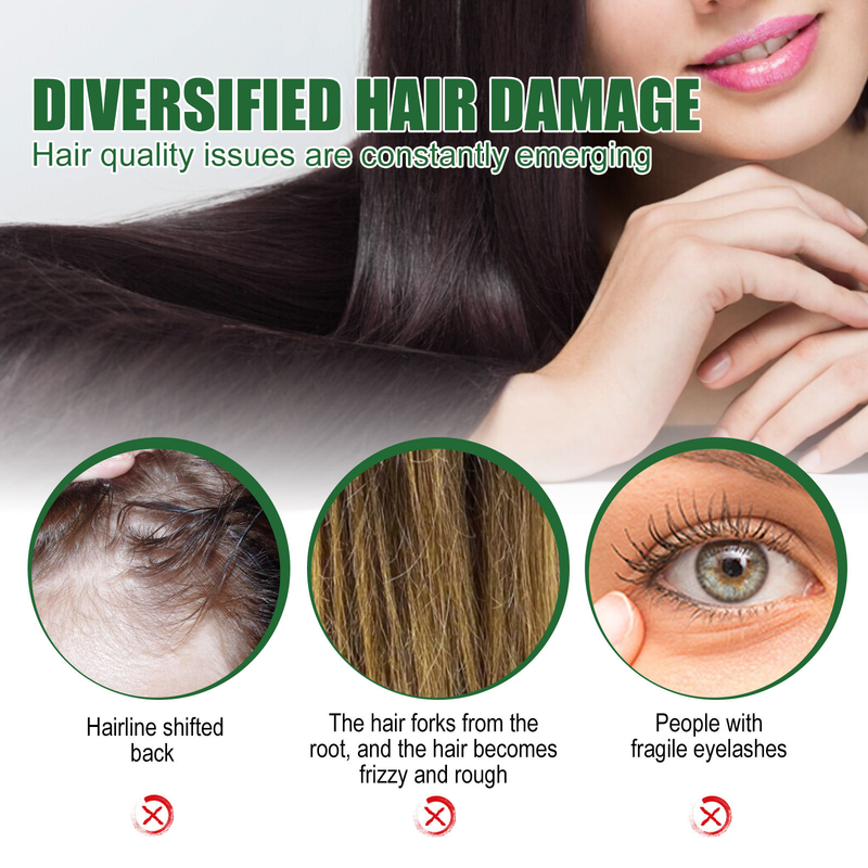 Διάλυμα καστορέλαιου EELHOE 24ss για την πρόληψη της τριχόπτωσης, τη σύσφιξη των μαλλιών, το μασάζ του τριχωτού της κεφαλής και τη θρεπτική φροντίδα,_voghion.com