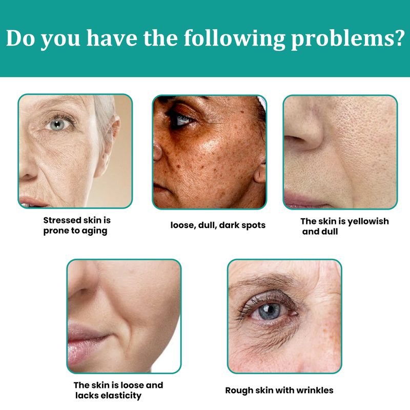 EELHOE Dark Spots Anti-Aging Serum, Lighten Dark Spots And Moisturize Skin Anti-Wrinkle Serum_voghion.com