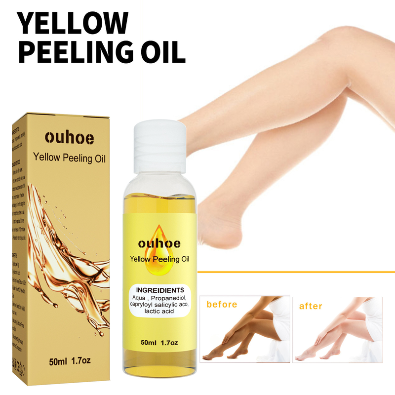 OUHOE Brightening reinigt gründlich, peelt abgestorbene Hautzellen, lässt Flecken verblassen und hellt das Hautpflegeöl auf_voghion.com
