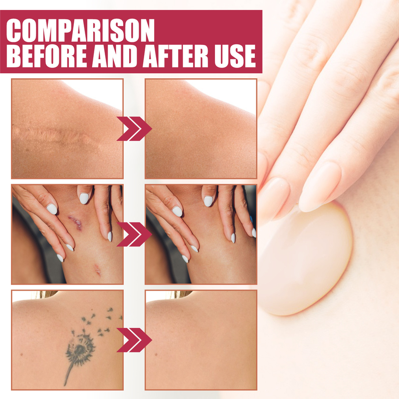 EELHOE Fondotinta liquido corpo Copre macchie cutanee, difetti del tatuaggio, idratazione naturale, trucco duraturo_voghion.com