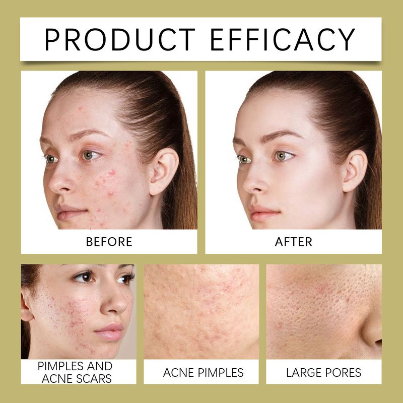 OUHOE čistilni prašek za čiščenje, fine pore, blago vlaženje, maska za nego kože obraza in vlaženje_voghion.com