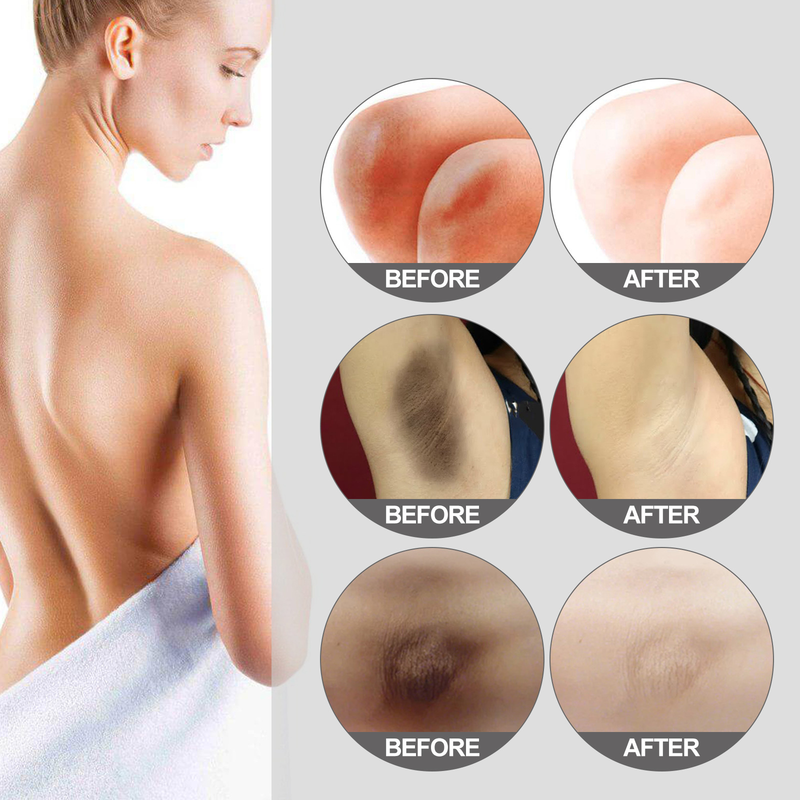 OUHOE whitening moisturizing cream lightens the darkness of underarm thigh knee joint_voghion.com