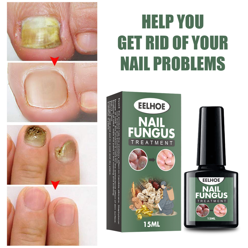 Nail Beautiful pelēks losjons rokām un kājām. Sirmu nagu kopšana un atjaunošana, baktēriju noņemšana. Sirmu nagu losjons biezākiem nagiem._voghion.com