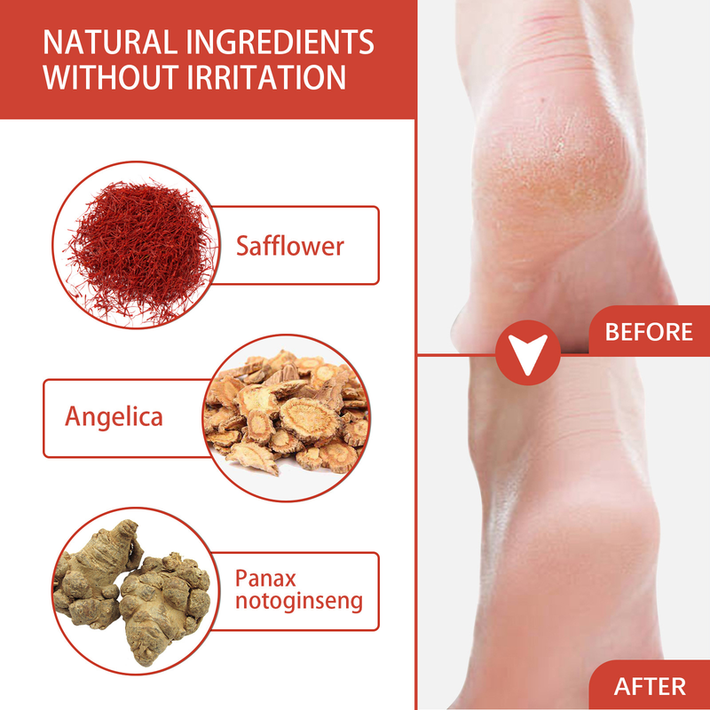 Moon South Heel Repair Cream Fußpeeling, Peeling, Anti-Trockenrissigkeit, Cocoon und Soft Foot Protection Cre_voghion.com