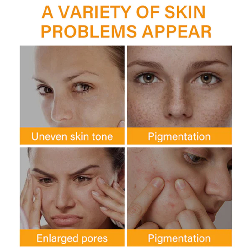 Acido della frutta Hoygi per indebolire le linee sottili, sollevare la pelle del viso, rassodare, idratare e resistere all'essenza delle rughe_voghion.com