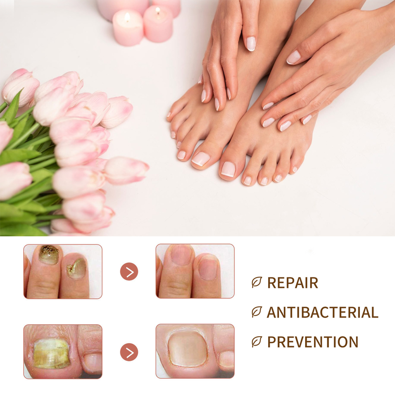 Nail Care Beautiful essence Liquid Repairing Hand, Foot, Nail, Toe, Grey Nail, Shining Nail Moisturizing Liquid , ,_voghion.com