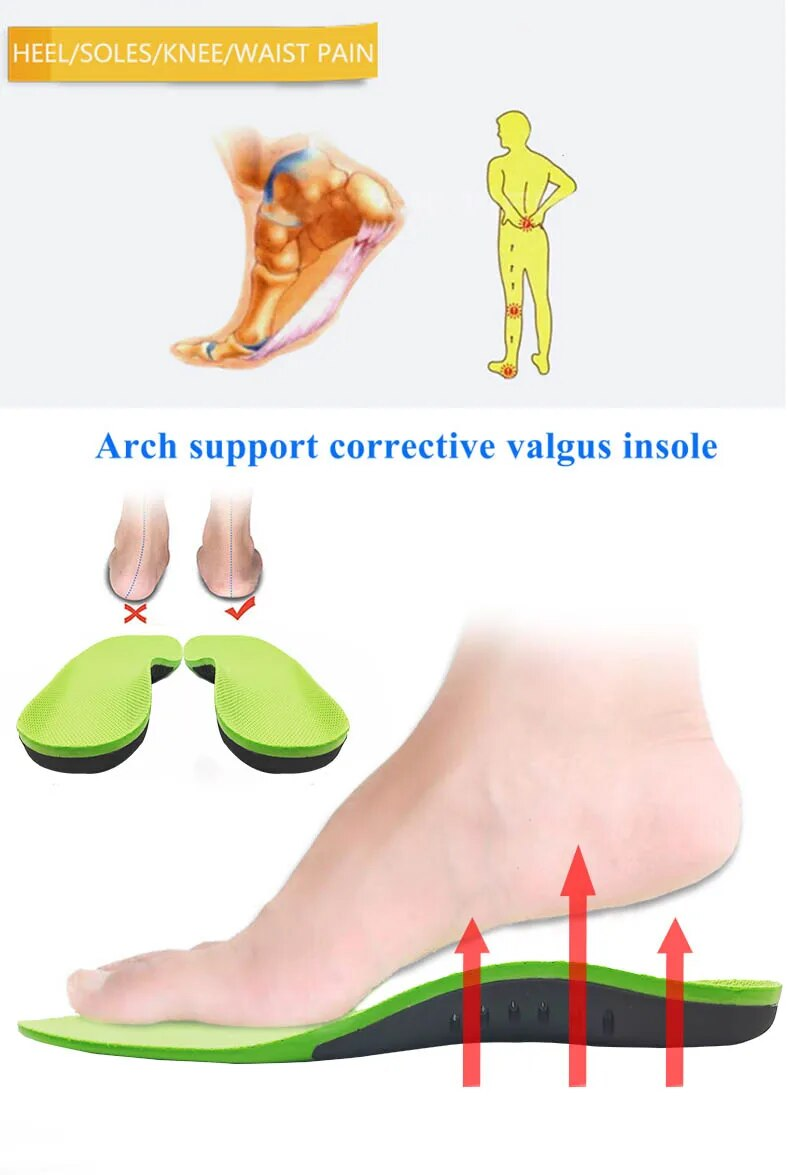 Solette ortopediche EU35-52 per piedi, tipo X/O, correzione delle gambe, supporto dell'arco plantare per piede piatto, inserto per scarpe sportive_voghion.com