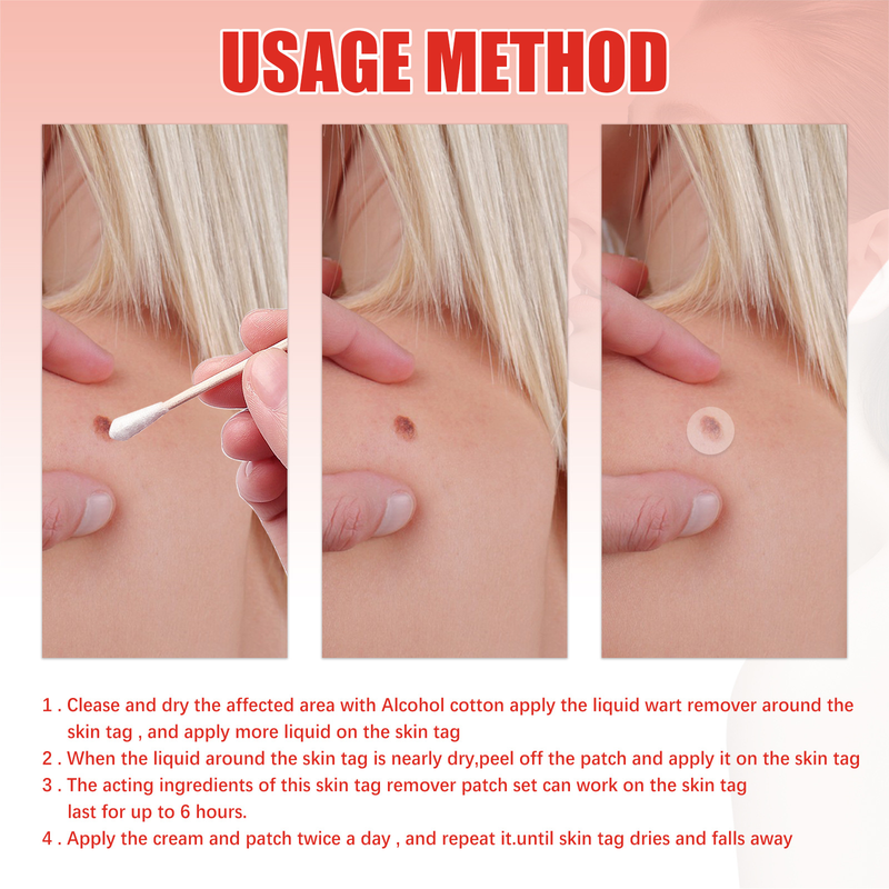 Removing Beautiful Verruca Set Skin Repair and Nevus Removing Patch Chicken Eyes, Barbs, Warts, Meat Granules Smooth B_voghion.com