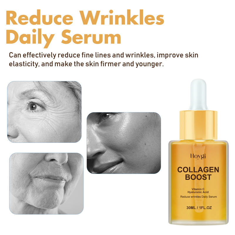 Hoygi Collagen Anti Wrinkle per sbiadire le linee sottili della testa, idratare e rassodare l'essenza della pelle_voghion.com