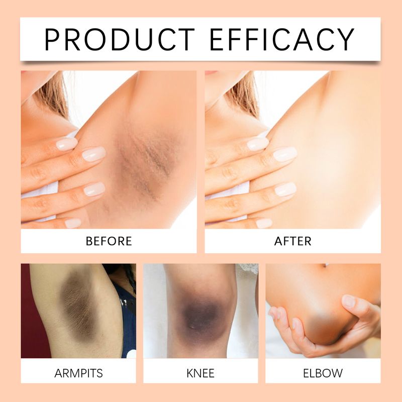 OceAura Underarm Skin Care Cream Underarm Skin Joint Black And Delicate Skin Moisturizing Cream_voghion.com