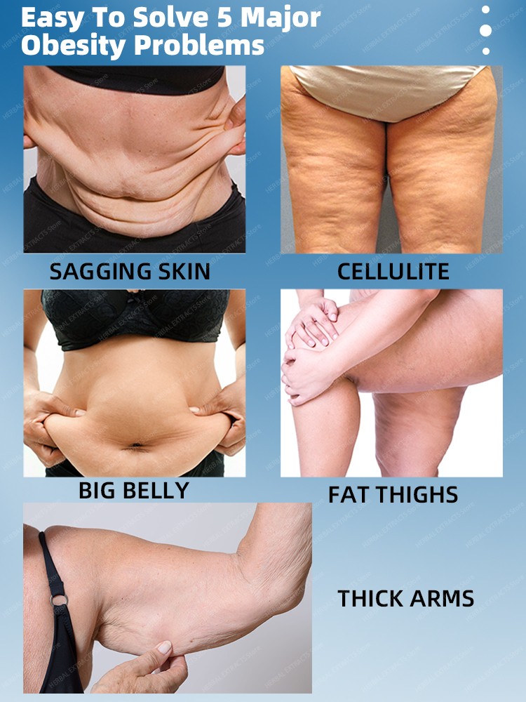 QLZHANFU Schnelle Schlankheitscreme, schnelle Gewichtsabnahme, wirksame Produkte zur Fettverbrennung_voghion.com