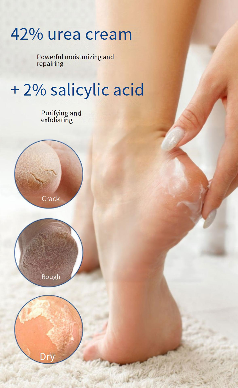 Lotions ARTKEN Crème à l'urée 42 % d'acide salicylique Automne et hiver Crème hydratante anti-dessèchement pour les mains Full English Spot_voghion.com
