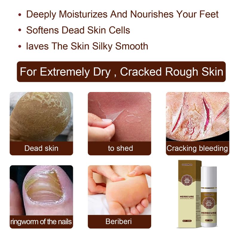 South Moon herbal sweat deodorant dehumidification foot odor care spray_voghion.com