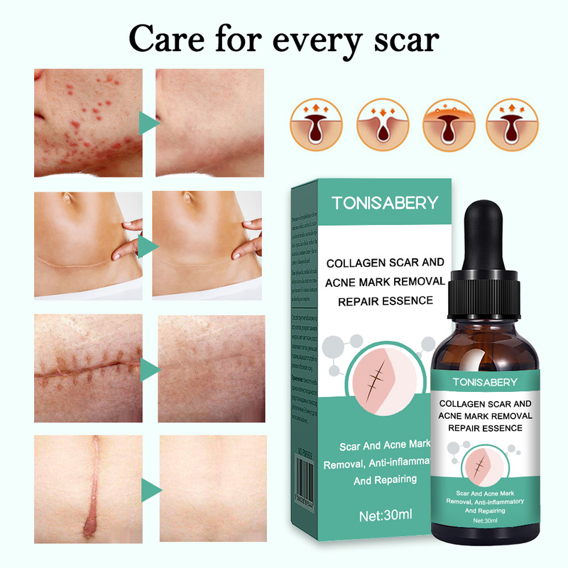 TONISABERY Collagen Care Mark Dilution Body essence 30ml Original Liquid_voghion.com