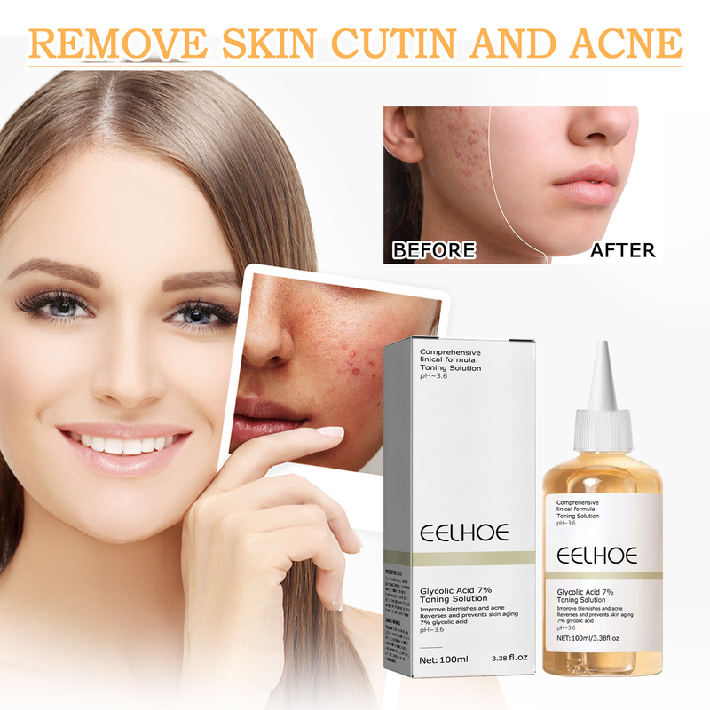 EELHOE Glycolic Acid 7% Toner Removal, Fading Acne Marks, Removing Closed Acne, Repairing Skin Moisturizing and_voghion.com