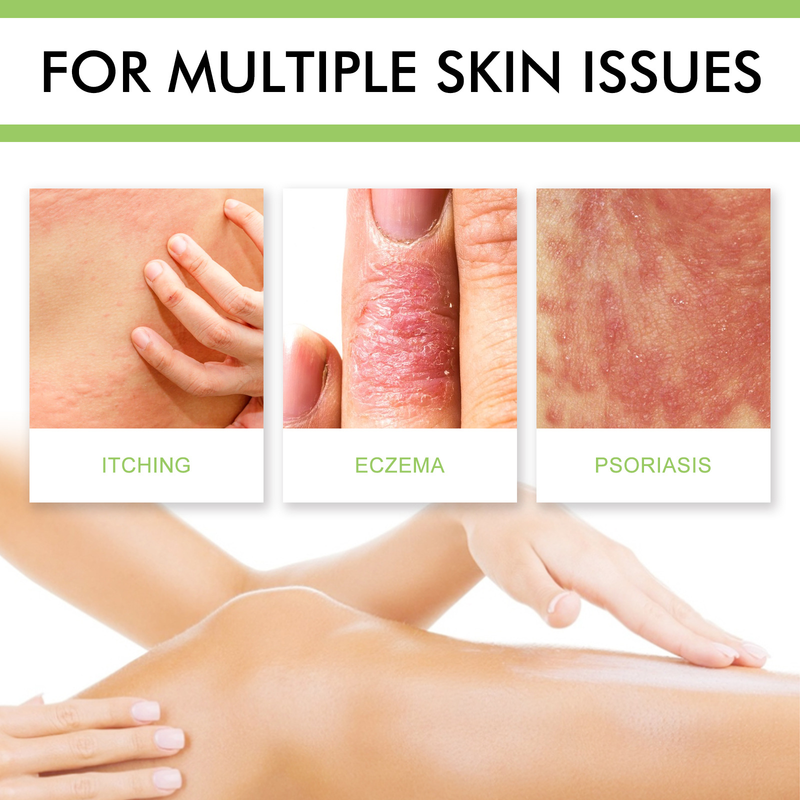South Moon Skin Cream, itchy, itchy, sensitive, red, itchy, antibacterial topical cream_voghion.com