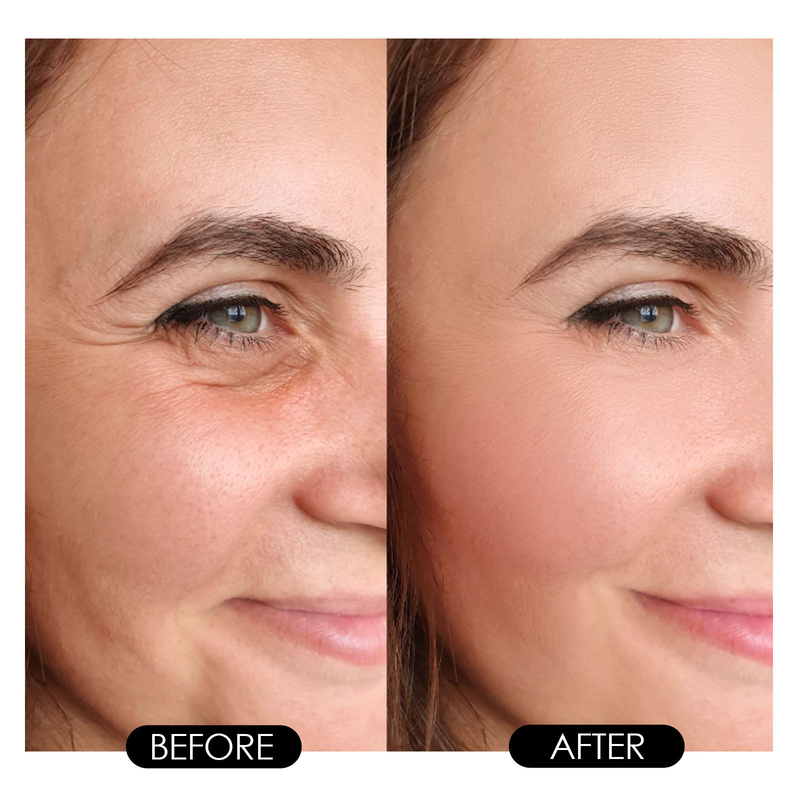 Hoygi Retinol-ældning Fugtgivende, opstrammende, anti-aging, lysende plet og fine linjer essens_voghion.com