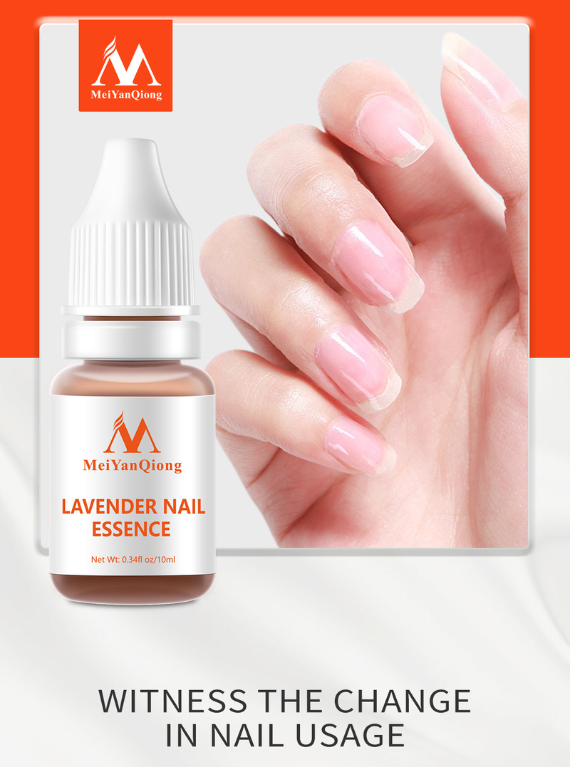 OLIO ESSENZIALE PER UNGHIE ALLA LAVANDA - 10 ml Cura naturale delle cuticole, idratazione e riparazione per unghie secche e fragili - Trattamento portatile per unghie da donna_voghion.com