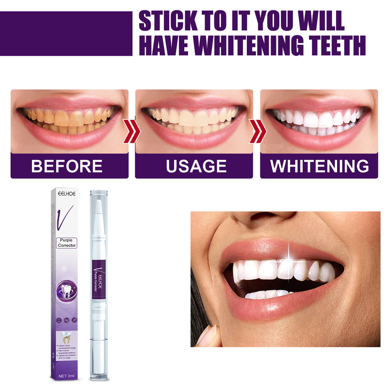 EELHOE V34 Purple Toner Whitening Pen für Zahnreinigung, Fleckenentfernung, Pigmentprävention und Mundpflege_voghion.com