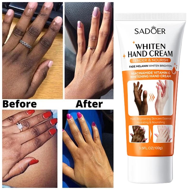 Aufhellende Handcreme für dunkle Fingerknöchel, Pigmentkorrektur, Anti-Riss-Serum, schwarze Haut, schneller Fleckenentferner, Hautpflegeprodukte_voghion.com